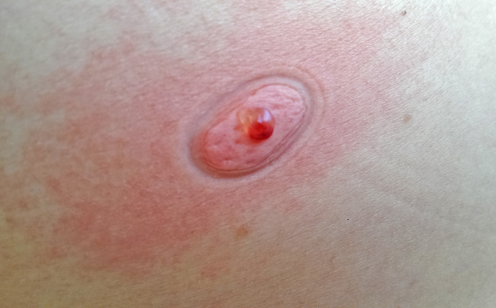 Екстрактор Sawyer The Extractor Pump Kit 8