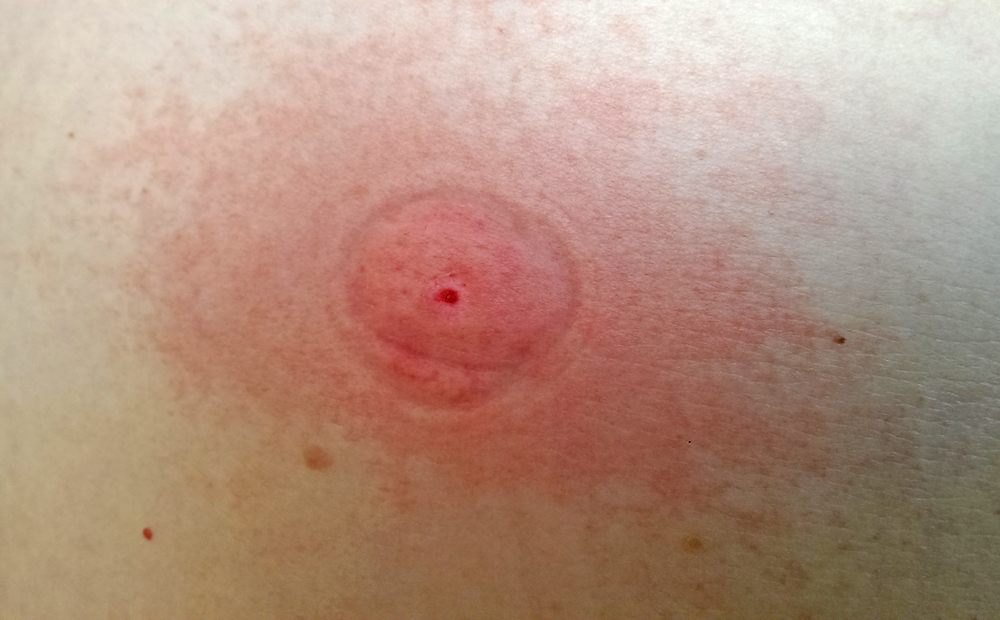 Екстрактор Sawyer The Extractor Pump Kit 9