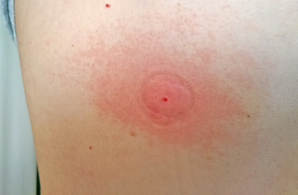 Екстрактор Sawyer The Extractor Pump Kit 10