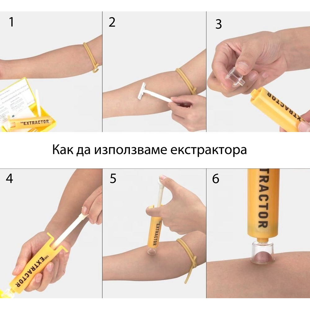 ЕКСТРАКТОР ПОМПА - комплект за извличане на отрова Extractor Pump Kit 5